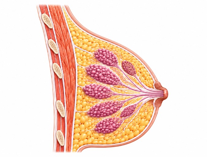 What Is Breast Cancer?