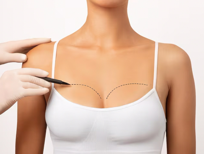 Breast Surgery in Lucknow India