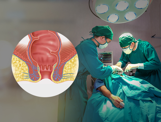Best Robotic Anorectal Surgery in Lucknow India