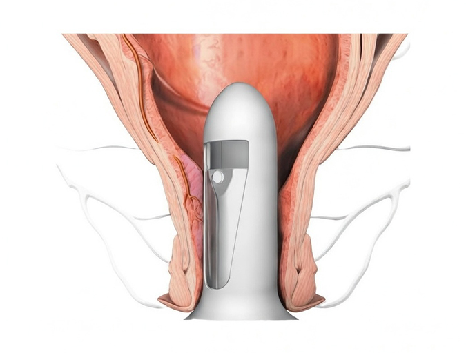 Best Hospital for Hemorrhoidal Artery Ligation in Lucknow India