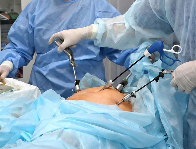 Laparoscopic Cholecystectomy in Lucknow India