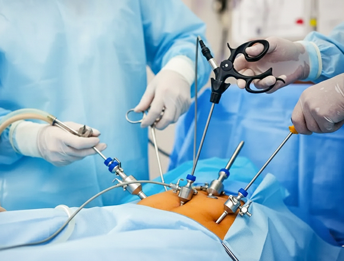 Minimally Invasive and Laparoscopic Gynecologic Surgery in Lucknow