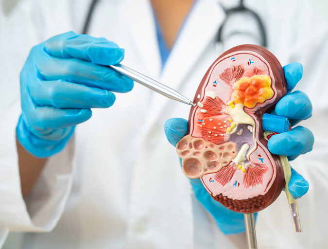 Renal Disease Treatment in Lucknow