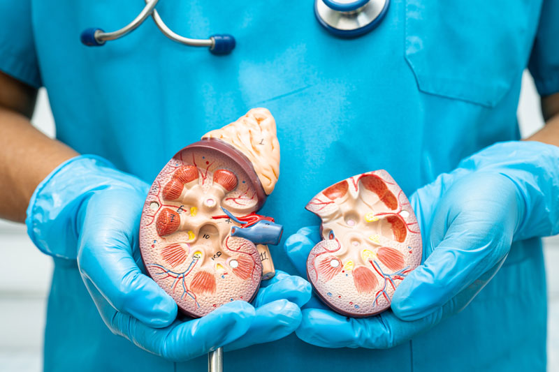 Uro-Oncology Treatment in Lucknow, India