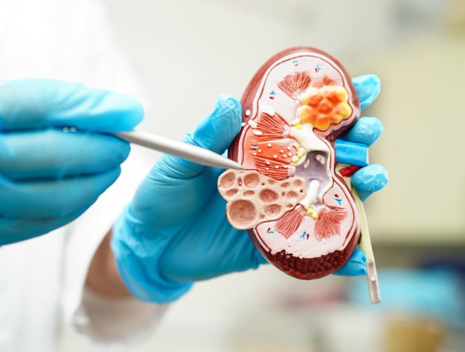 Uro-Oncology Hospital in Lucknow, India